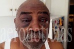 Un anciano sordo, golpeado por policías en EE.UU. por no oír sus órdenes. (aeronoticias.com.pe)